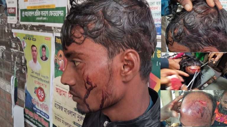 হাতিয়ায় ডাকাত স্বপন বাহিনীর নির্যাতনে আহত ৭, ৪জনের অবস্থা আশংকাজনক!